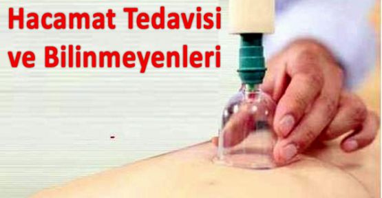 HACAMAT TEDAVİSİ VE BİLİNMEYENLERİ